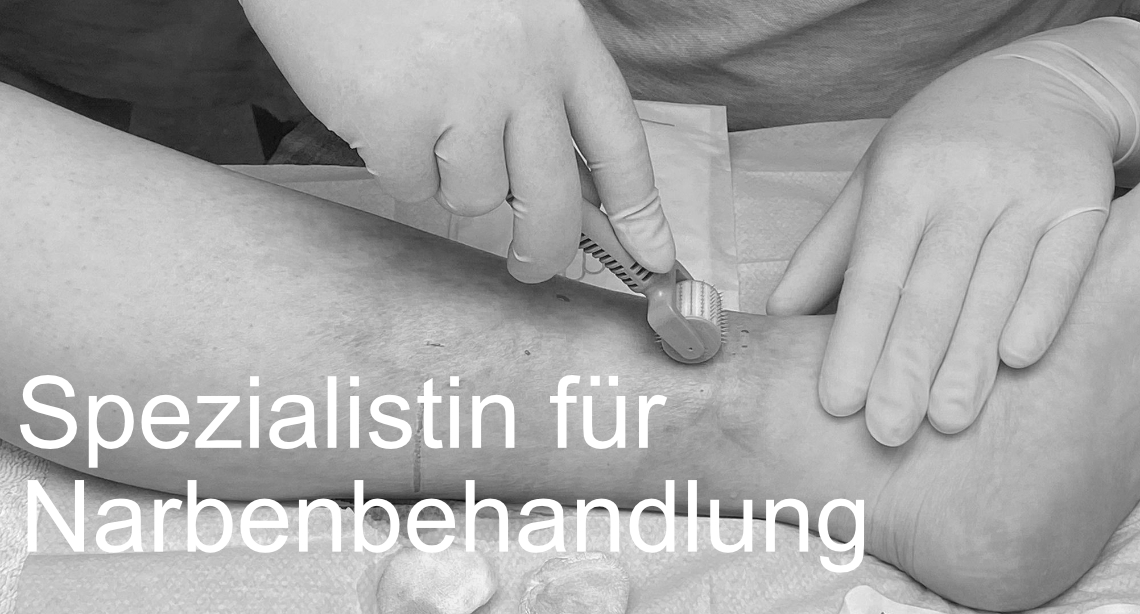 Microneedling